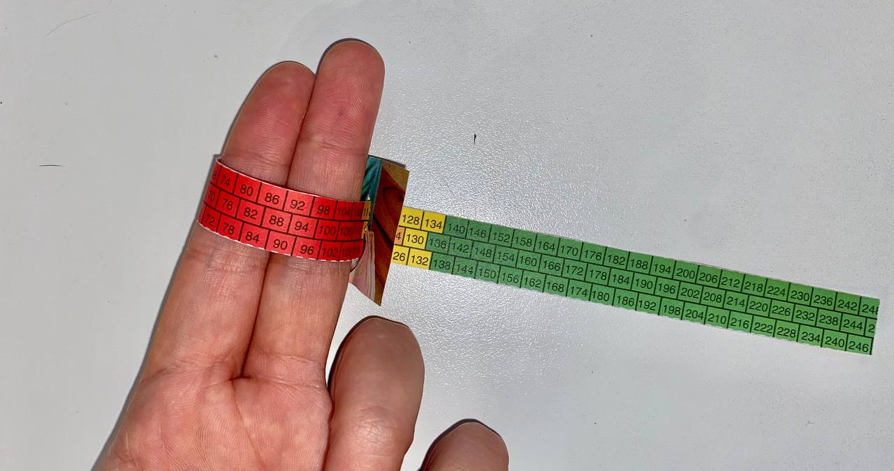 Medici Senza Frontiere "mostra" la malnutrizione con un braccialetto