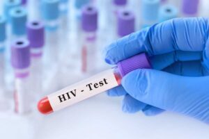 HIV cura iniezione ogni due mesi